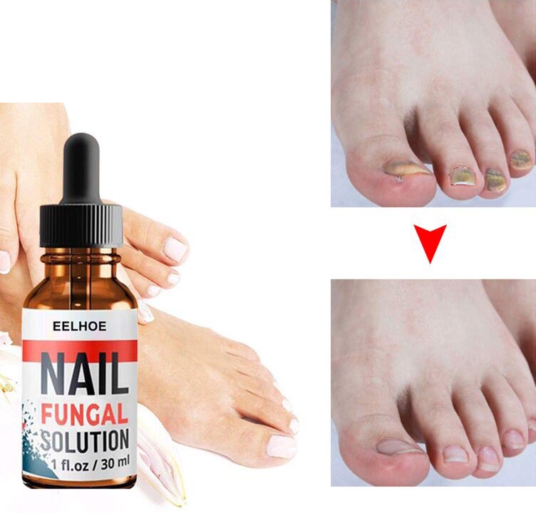 Ulje za negu noktiju 30 ml – slika 6
