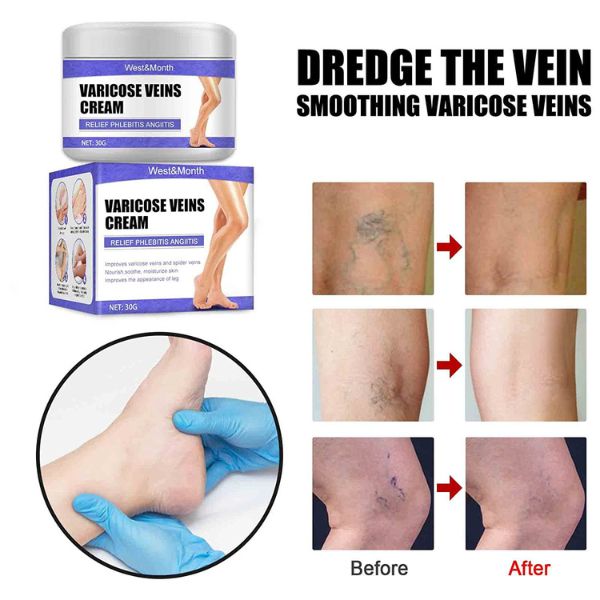 Krema za negu kože nogu 30 ml – slika 3