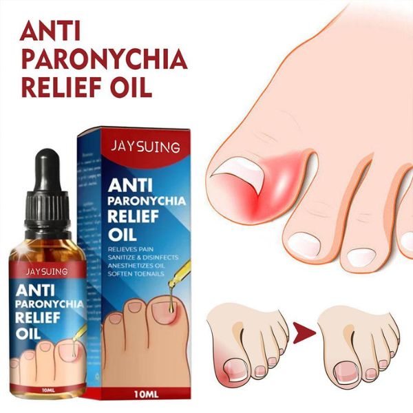 Ulje za negu noktiju 10 ml