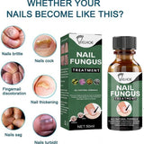 PRODAVANI serum za negu noktiju