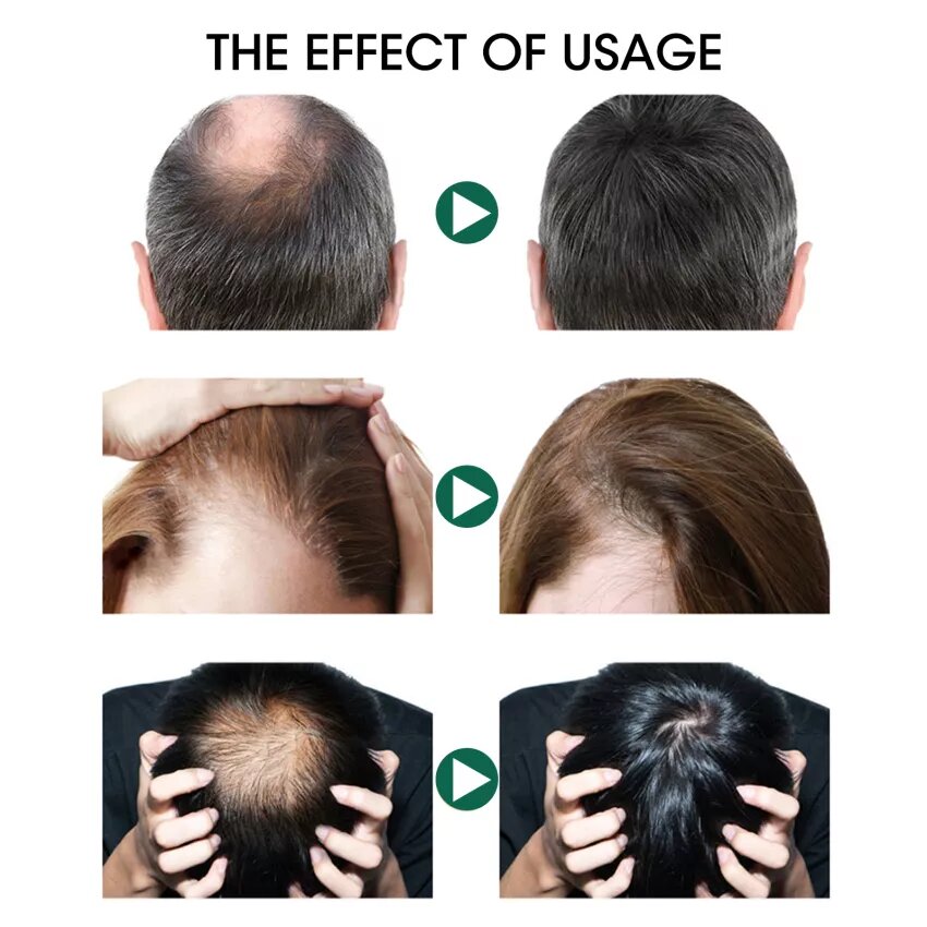 Ulje za kosu sa đumbirom 30 ml – slika 5