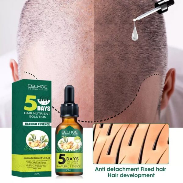 Ulje za kosu sa đumbirom 30 ml