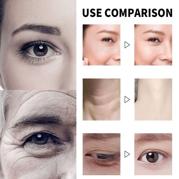 Serum za lice sa vitaminom C i hijaluronskom kiselinom – slika 2