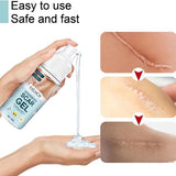 Silikonski gel za negu kože sa ožiljcima
