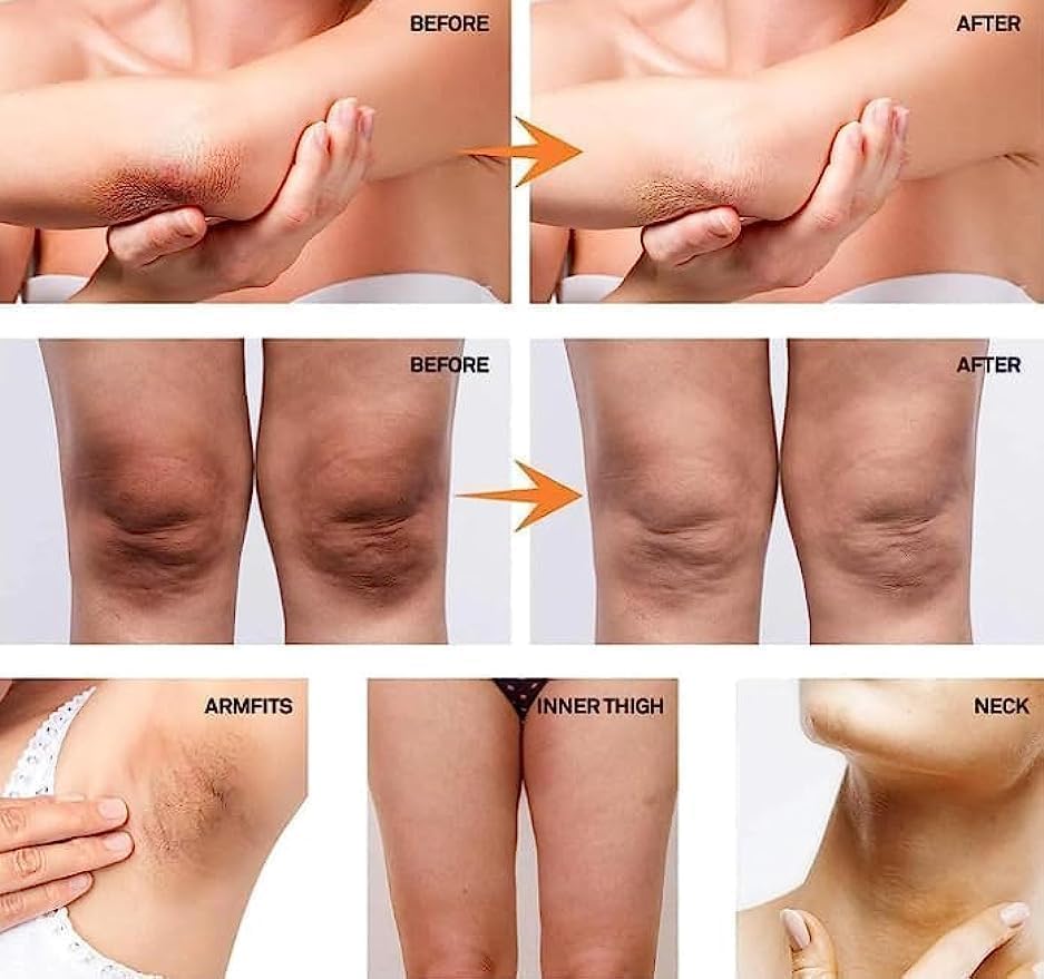 Krema za negu osetljivih delova kože 30 ml – slika 3