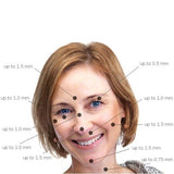 Derma roler sa 540 iglica za negu kože lica i tela