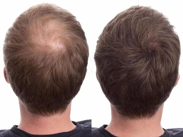 Keratinski fiberi za vizuelno gušću kosu – 27,5 g – slika 3